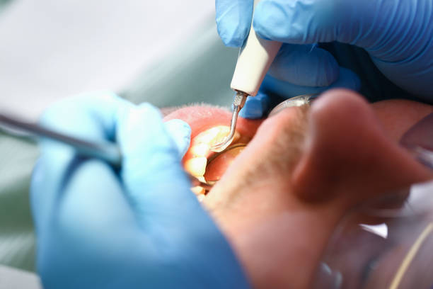 Best Emergency Treatment for Dental Infections or Abscesses in Campbellsburg, KY